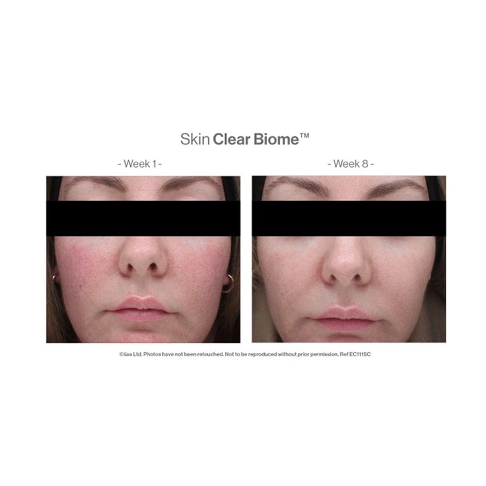 Advanced Nutrition Vitamins & Supplements Advanced Nutrition Programme Skin Clear Biome