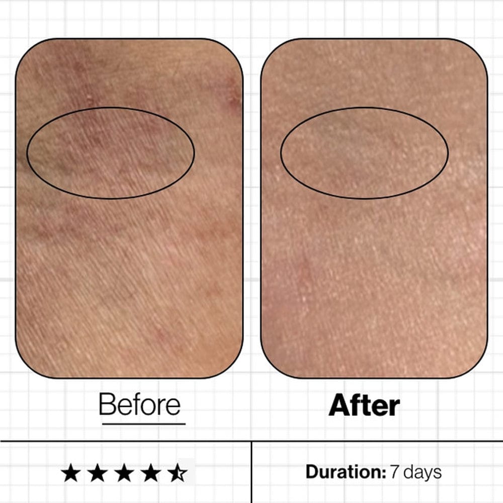 Advanced Nutrition Vitamins & Supplements Advanced Nutrition Programme Skin Moisture IQ