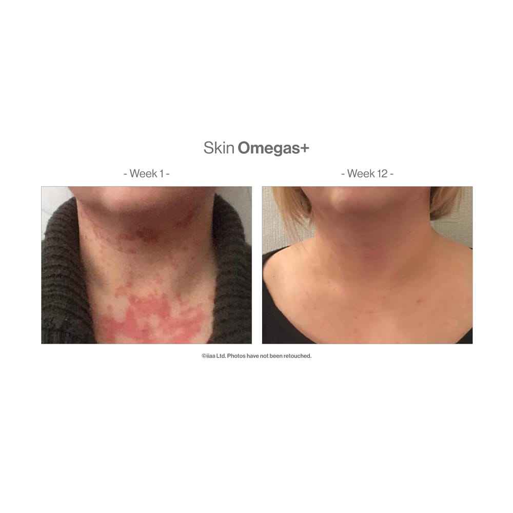 Advanced Nutrition Vitamins & Supplements Advanced Nutrition Programme Skin Omegas+