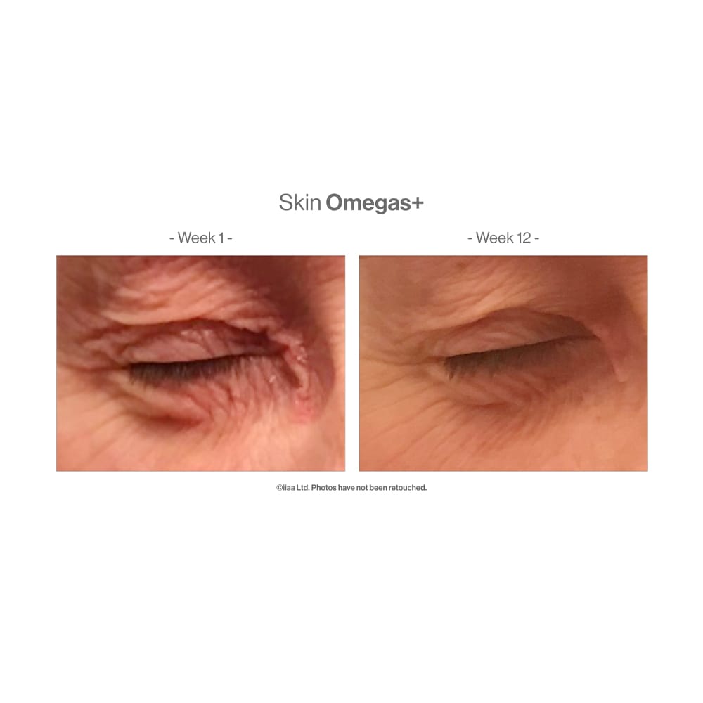 Advanced Nutrition Vitamins & Supplements Advanced Nutrition Programme Skin Omegas+