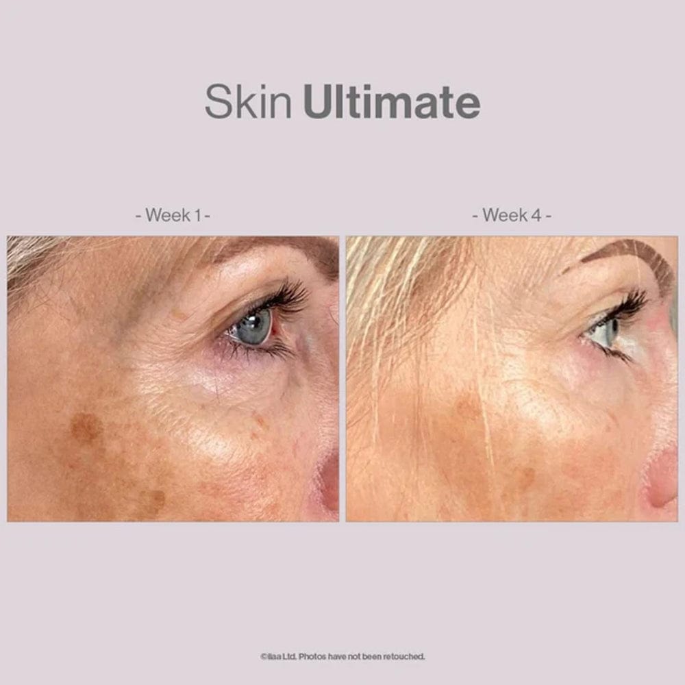 Advanced Nutrition Vitamins & Supplements Advanced Nutrition Skin Ultimate 28 Pods of Beauty