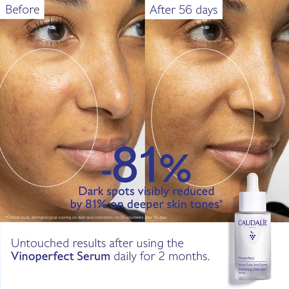 Caudalie Serum Caudalie Vinoperfect Brightening Dark Spot Serum