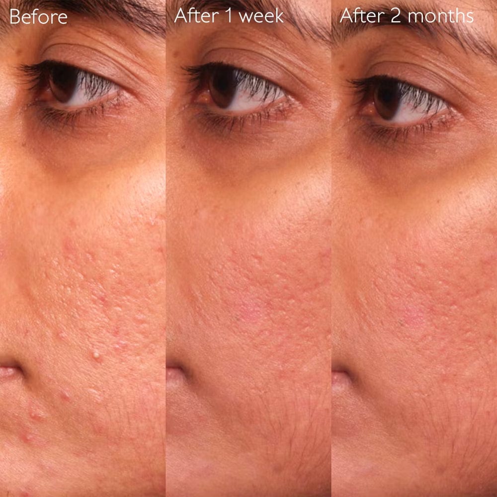 Caudalie Serum Caudalie Vinopure Blemish Control Salicylic Serum 30ml