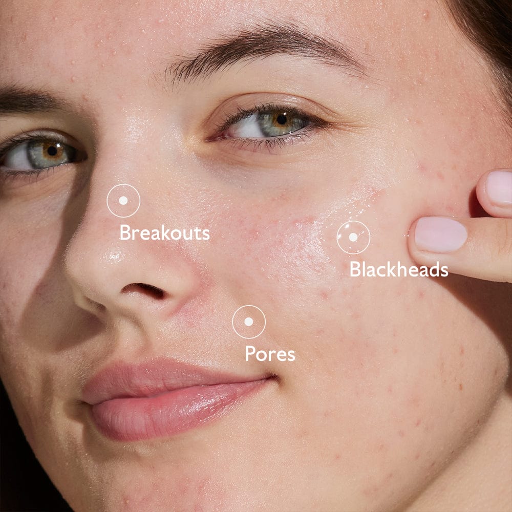 Caudalie Serum Caudalie Vinopure Blemish Control Salicylic Serum 30ml