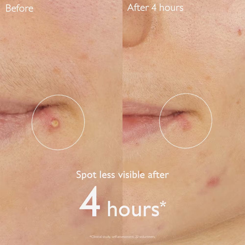 Caudalie Spot Treatment Caudalie Vinopure Salicylic Spot Solution 15ml