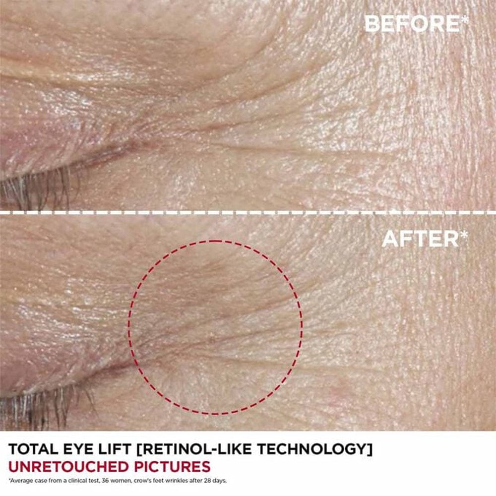 Clarins Eye Serum Clarins Total Eye Lift Serum 15ml