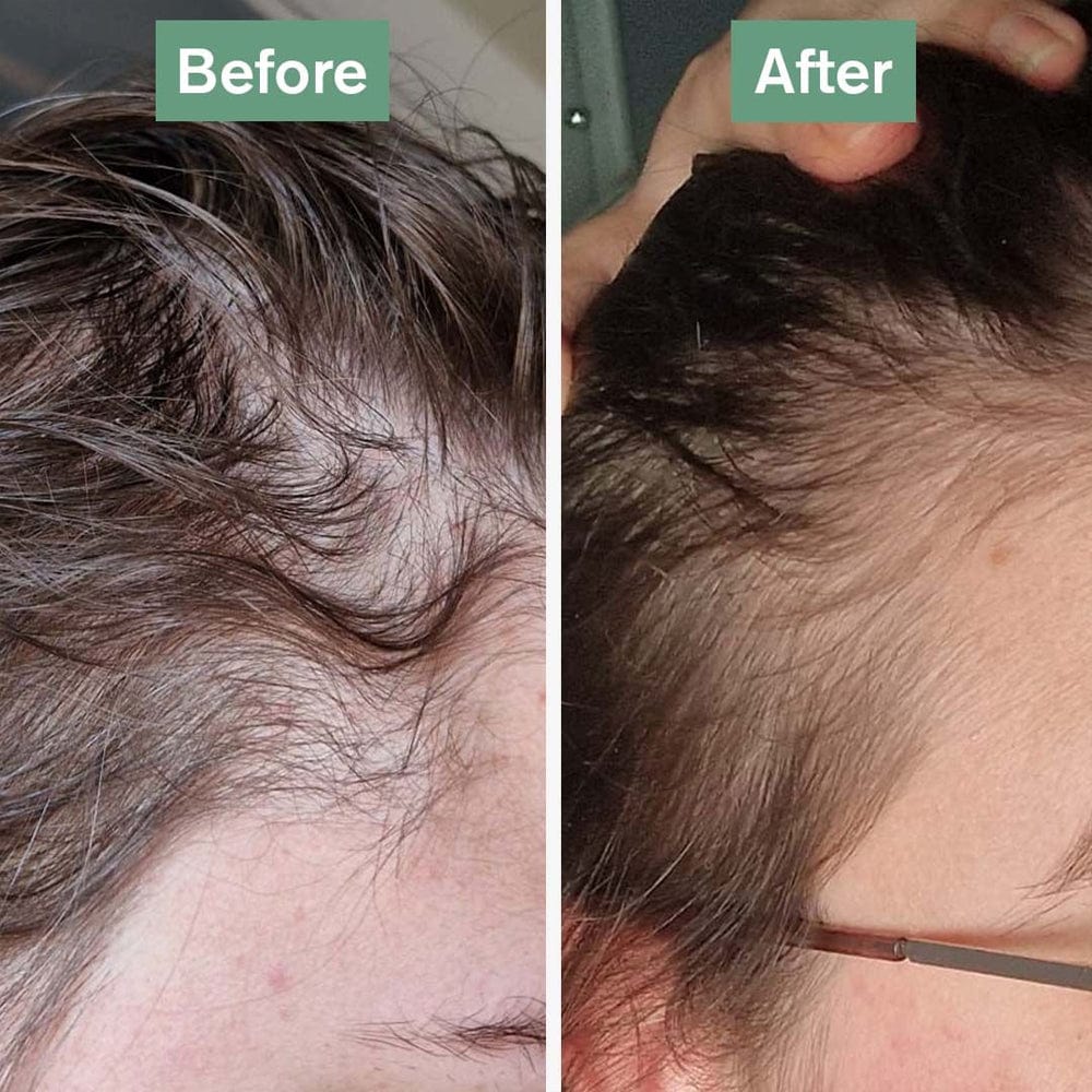 DR.VEGAN Vitamins & Supplements DR.VEGAN Hair Saviour