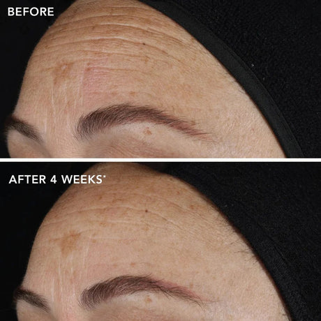 Image Skincare Retinol IMAGE AGELESS+ Retinol Pure Liquid Retinol 0.1% 30ml