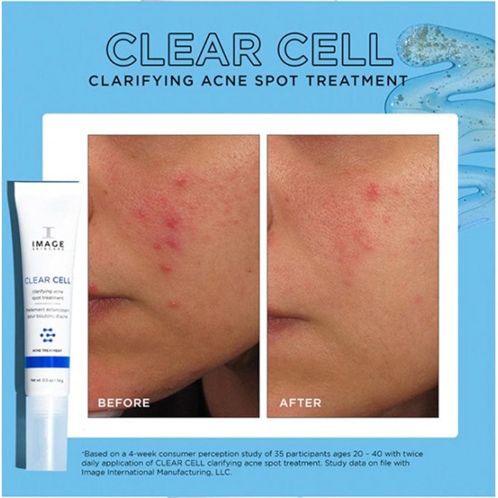 Image Skincare Skin Treatment Image Clear Cell Clarifying Salicylic Blemish Gel