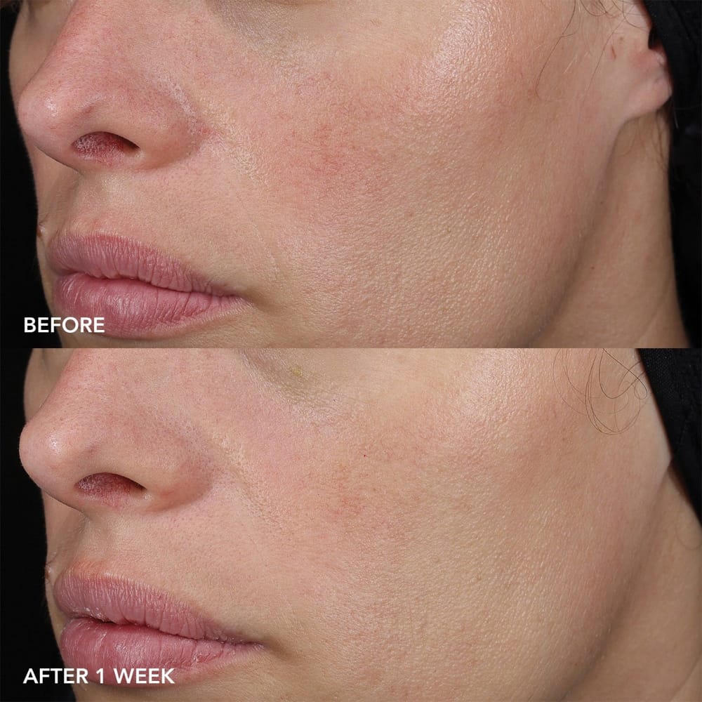 Image Skincare Recovery Balm IMAGE MD Barrier Repair Recovery Balm 57g