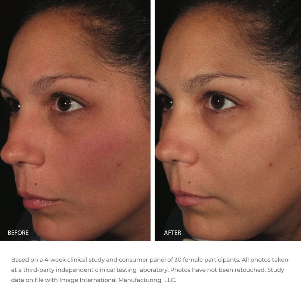 Image Skincare Serum IMAGE Ormedic Balancing Antioxidant Serum 30ml