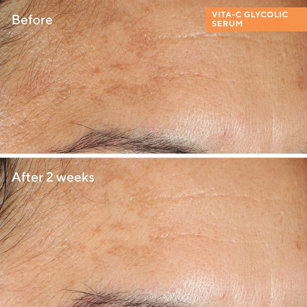 Murad Serum Murad Murad Vita-C Glycolic Brightening Serum 30ml