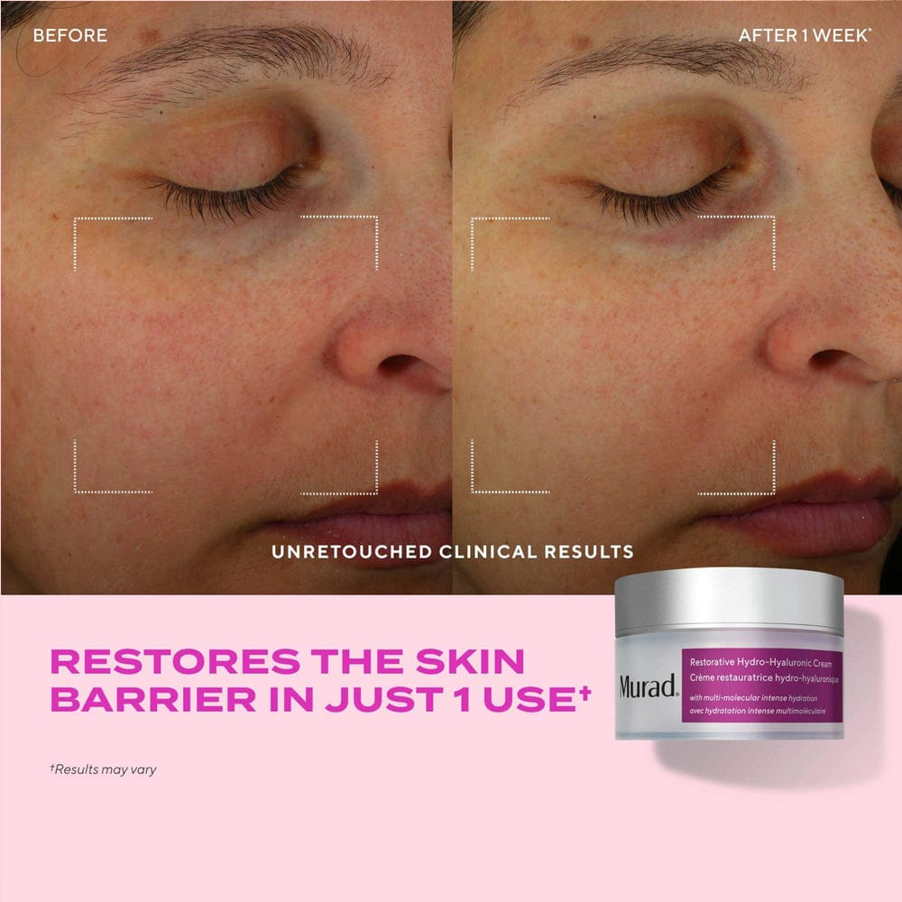 Murad Moisturiser Murad Restorative Hydro-Hyaluronic Cream 50ml