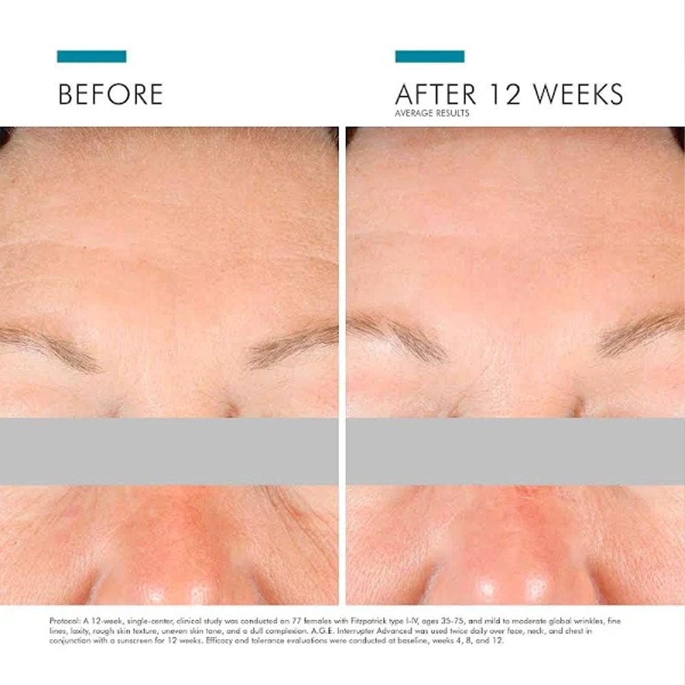 Skinceuticals Face Moisturisers SkinCeuticals A.G.E. Interrupter Advanced 48ml