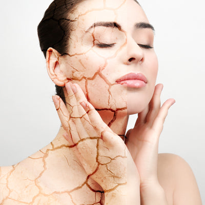 How to treat dry, tight skin