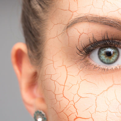 Signs of dehydrated skin and how to treat it