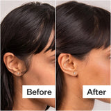 Act+Acre Scalp Serum Act+Acre 4% Niacinamide Oily Scalp Serum 65ml