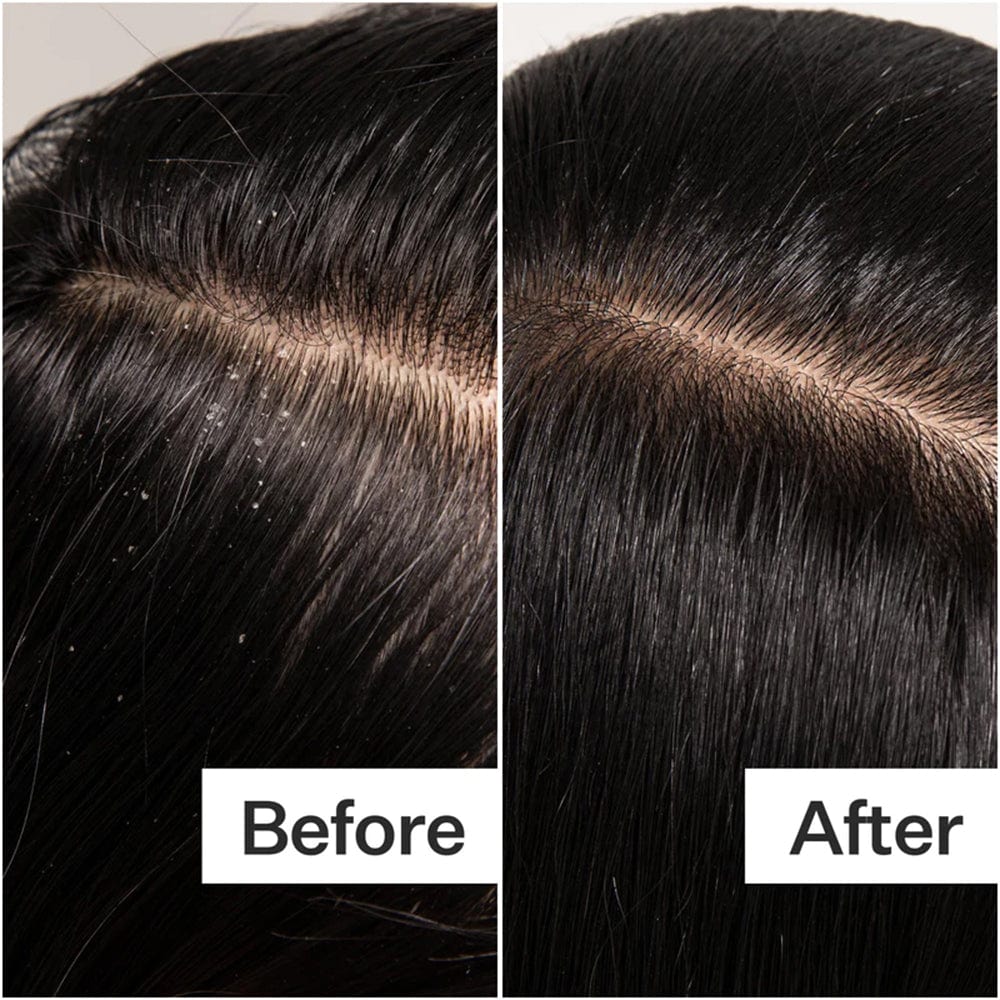 Scalp Detox | Midas Wellness Hub