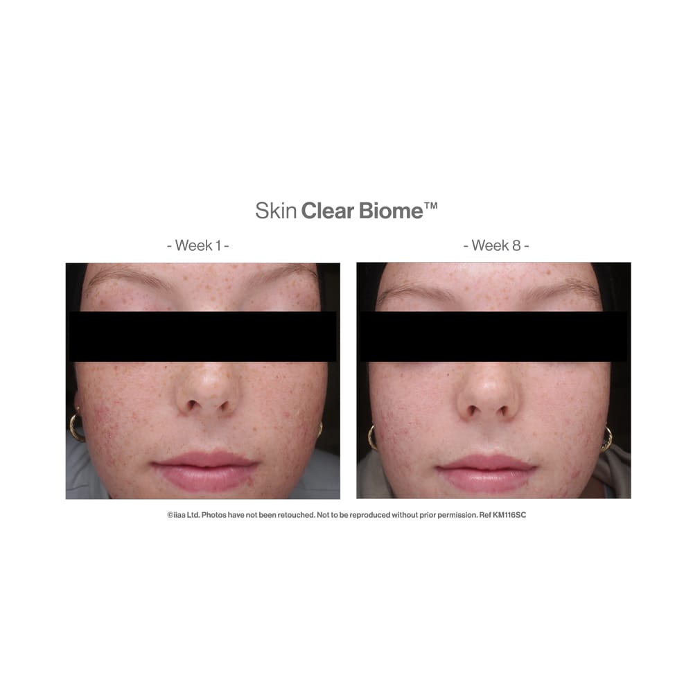 Advanced Nutrition Vitamins & Supplements Advanced Nutrition Programme Skin Clear Biome