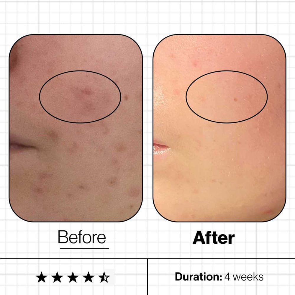 Advanced Nutrition Vitamins & Supplements Advanced Nutrition Programme Skin Clear Biome