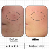 Advanced Nutrition Vitamins & Supplements Advanced Nutrition Programme Skin Clear Biome