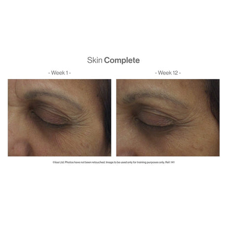 Advanced Nutrition Vitamins & Supplements Advanced Nutrition Programme Skin Complete 120 Capsules