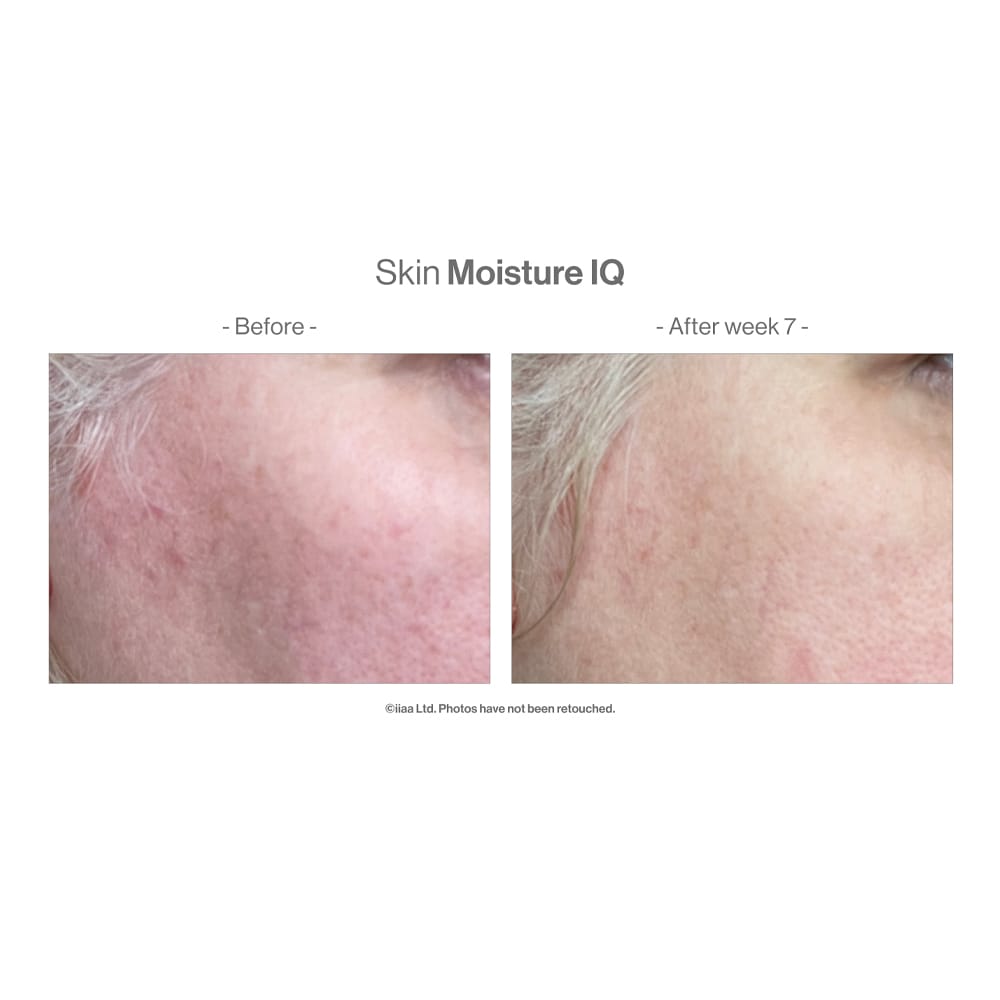 Advanced Nutrition Vitamins & Supplements Advanced Nutrition Programme Skin Moisture IQ