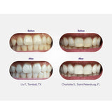 Burst Oral Care Teeth Whitening Strips Burst Non-Slip Whitening Strips 10 Treatments