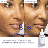 Caudalie Serum Caudalie Vinoperfect Brightening Dark Spot Serum