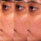 Caudalie Serum Caudalie Vinopure Blemish Control Salicylic Serum 30ml