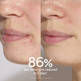 Caudalie Serum Caudalie Vinopure Blemish Control Salicylic Serum 30ml