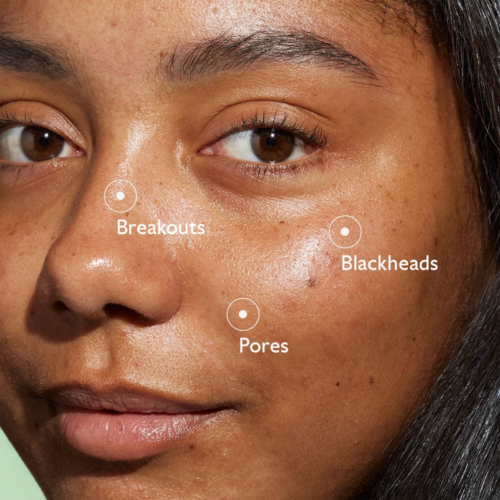 Caudalie Serum Caudalie Vinopure Blemish Control Salicylic Serum 30ml