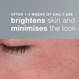 Dermalogica Exfoliator Dermalogica Daily Microfoliant Exfoliator