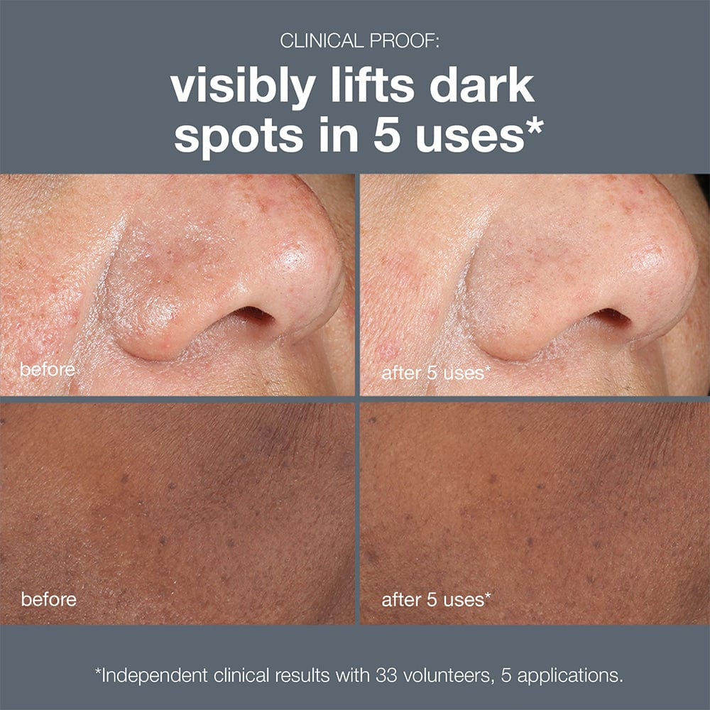 Dermalogica Facial Peel Dermalogica Powerbright Dark Spot Peel 50ml