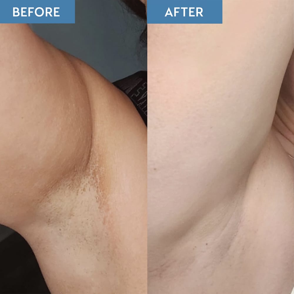 He-Shi Tan Remover He-Shi Tan Remover & Primer