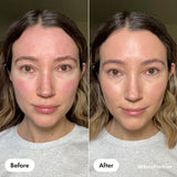 Hero. Skin Balm Hero Rescue Balm + Red Correct 15ml