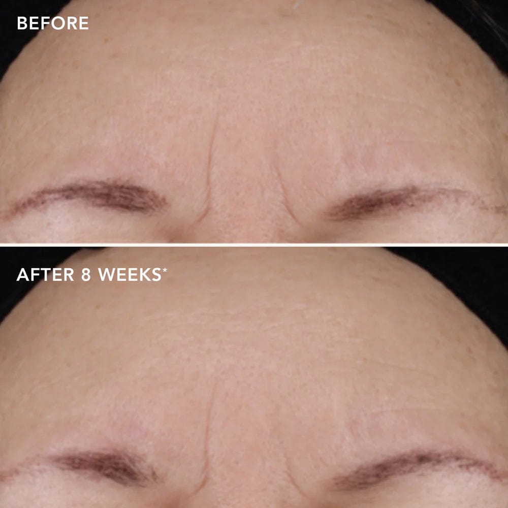 Image Skincare Skin Treatment IMAGE AGELESS+ Treatment Crème 1.2% Retinol Complex