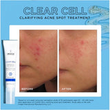 Image Skincare Skin Treatment Image Clear Cell Clarifying Salicylic Blemish Gel