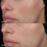 Image Skincare Recovery Balm IMAGE MD Barrier Repair Recovery Balm 57g