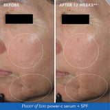 Image Skincare Serum IMAGE MD Restoring Power-C Serum 30ml