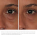 Image Skincare Eye Cream IMAGE Ormedic Balancing Eye Lift Gel 15ml