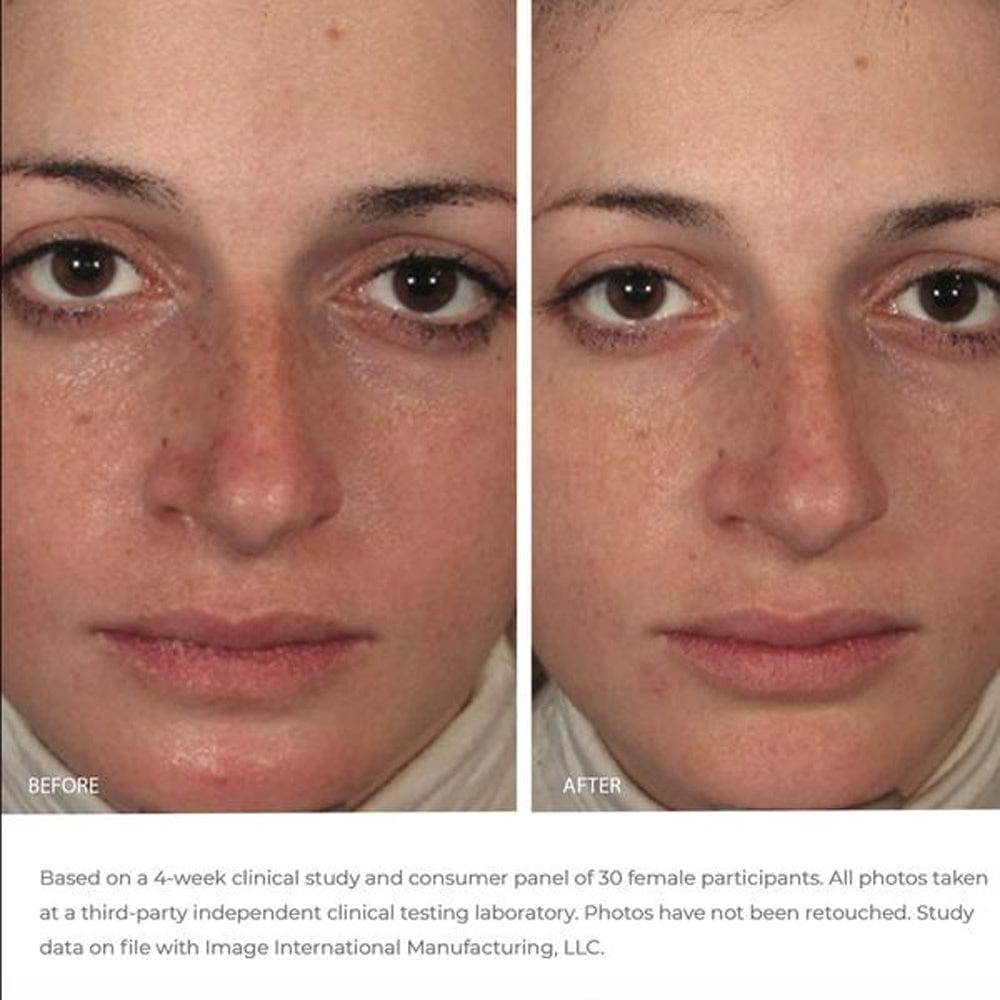 Image Skincare Face Mask IMAGE Ormedic Balancing Masque 59ml