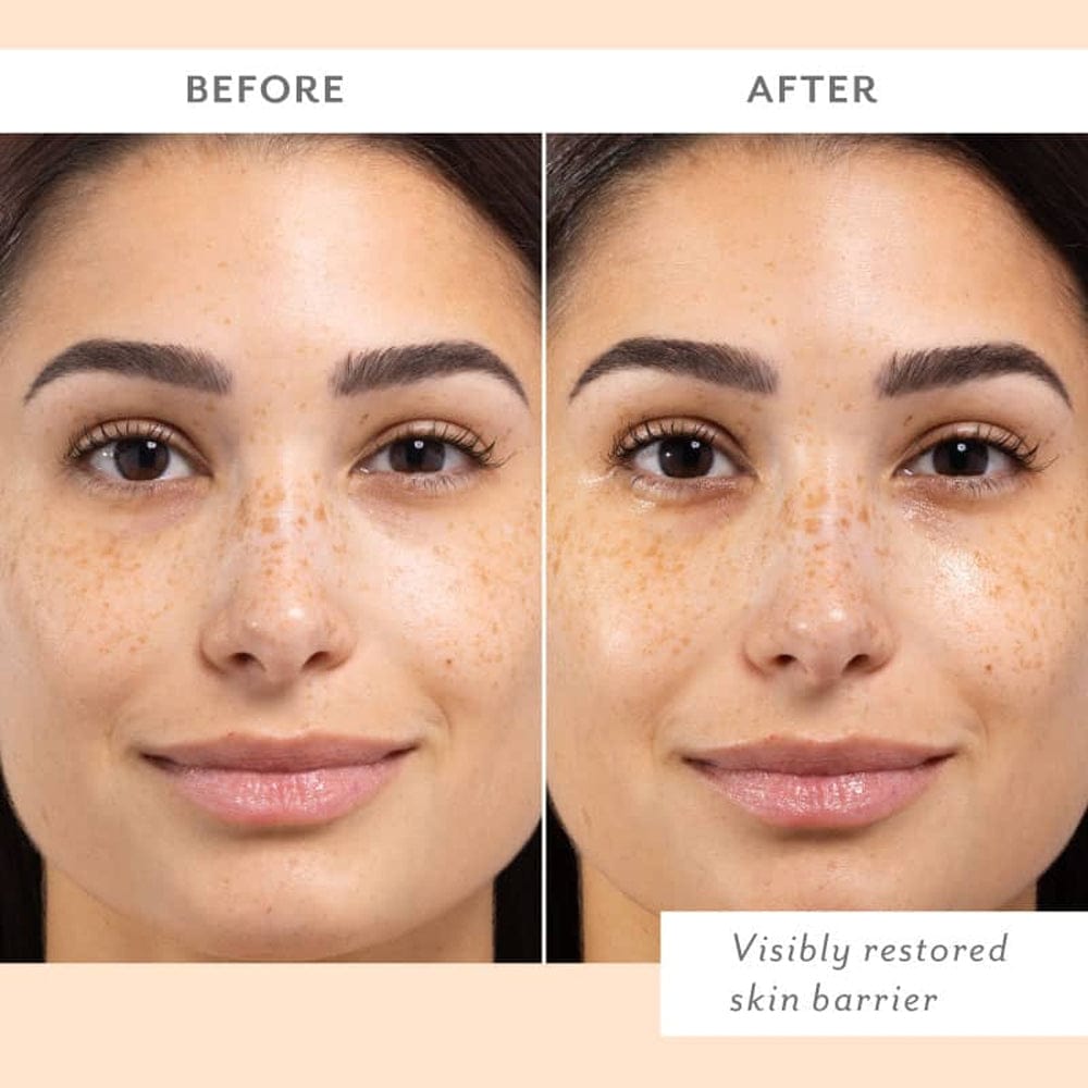 Patchology Sheet Mask Patchology Skin Remedy Barrier-Boosting Sheet Mask