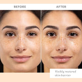 Patchology Sheet Mask Patchology Skin Remedy Barrier-Boosting Sheet Mask