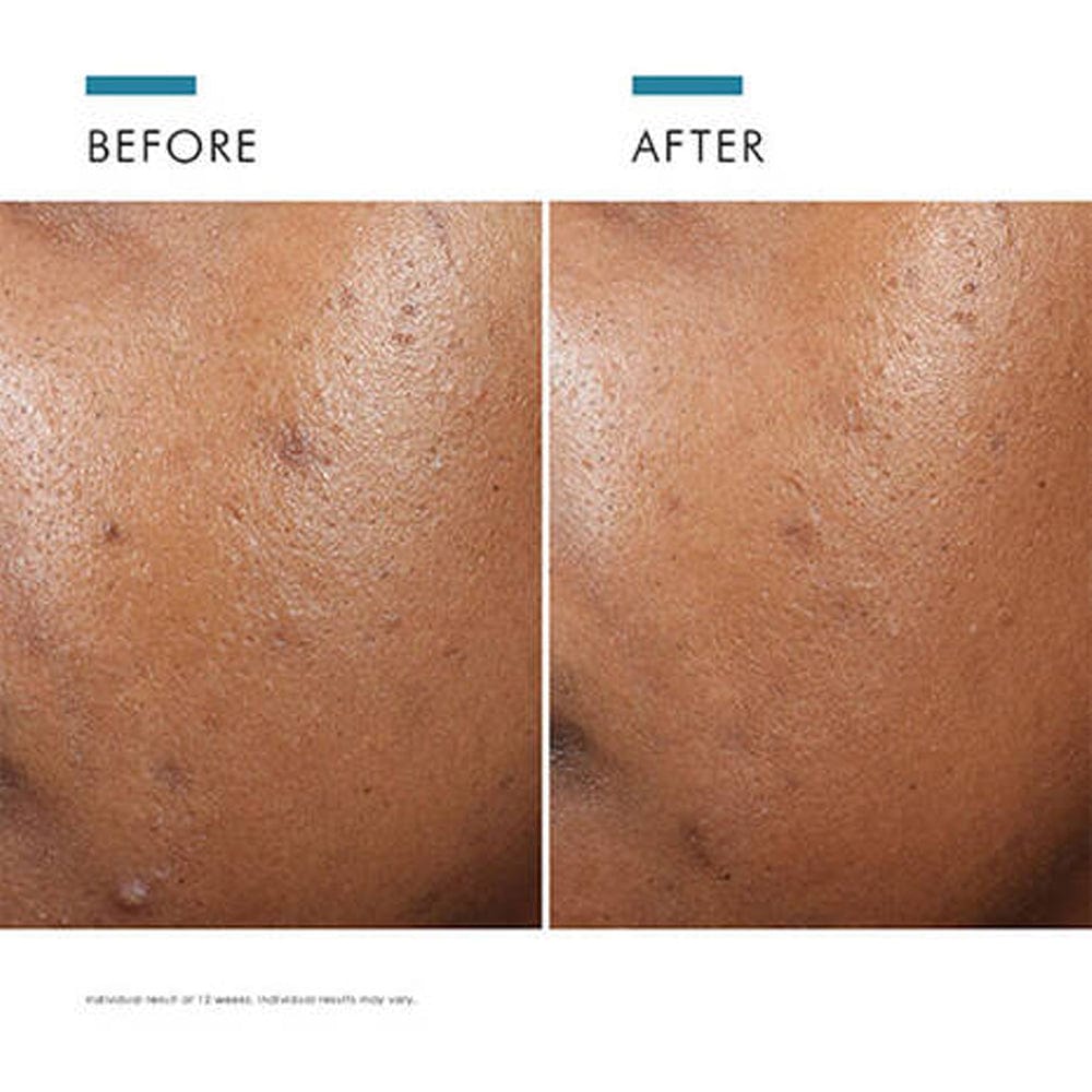 Skinceuticals Face Moisturisers SkinCeuticals Phyto A + Brightening Treatment 30ml
