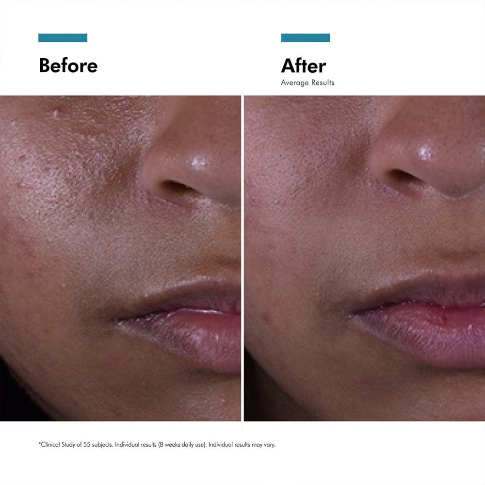 Skinceuticals Skincare Kit SkinCeuticals Silymarin CF Double Defence Kit