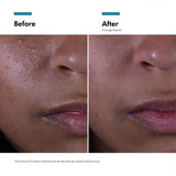 Skinceuticals Skincare Kit SkinCeuticals Silymarin CF Double Defence Kit