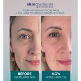 Skingredients Eye gels Skingredients Eye-Light Eye-Bright Arbutin Under Eye Pads