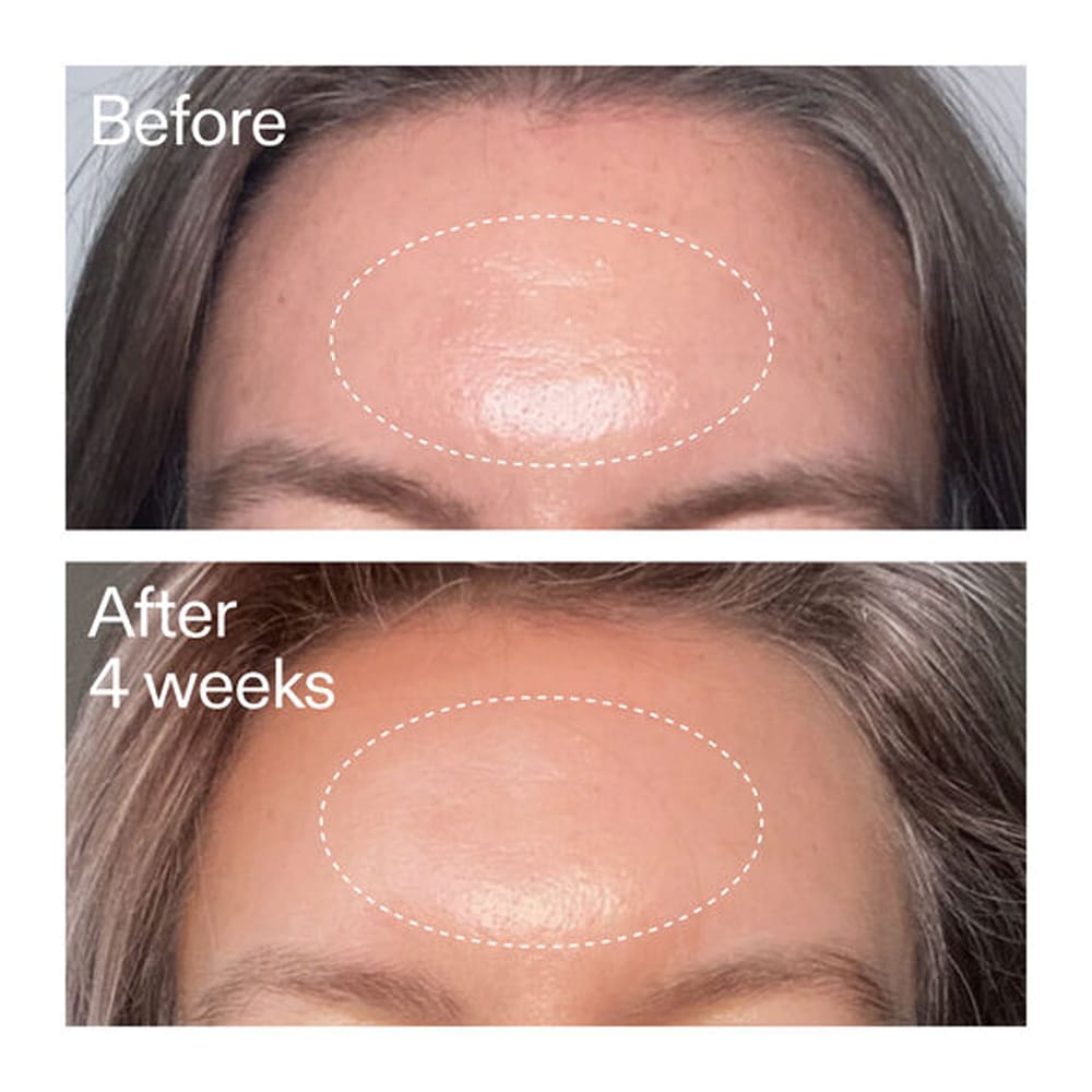 The Inkey List Retinol The INKEY List Advanced Retinal Serum 15ml