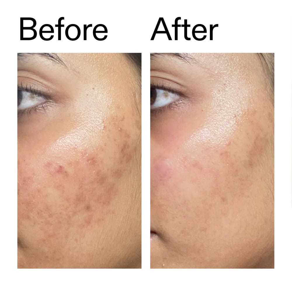The Inkey List Serum The Inkey List Ectoin Hydro-Barrier Serum 30ml